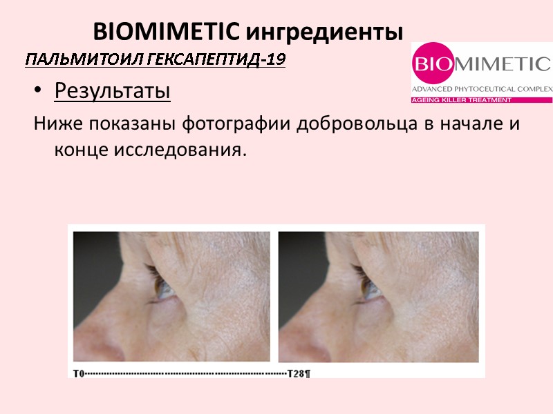 Результаты Ниже показаны фотографии добровольца в начале и конце исследования. ПАЛЬМИТОИЛ ГЕКСАПЕПТИД-19  BIOMIMETIC